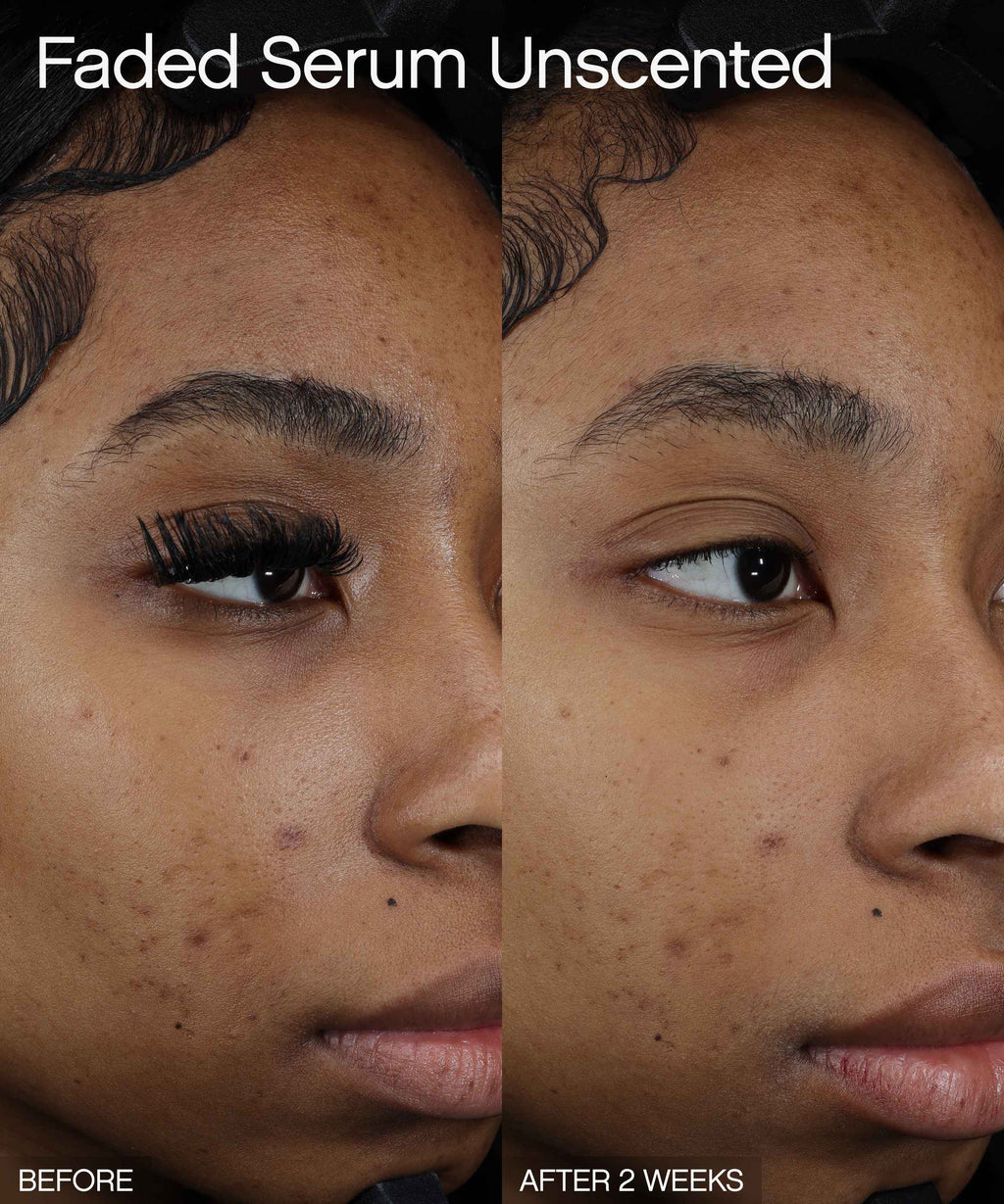 Discoloration Duo